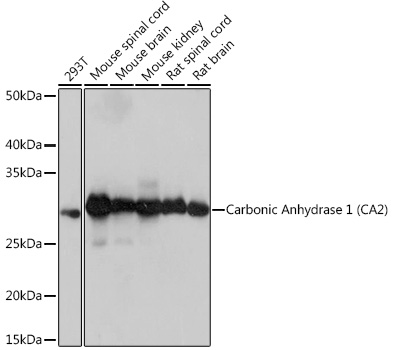 Carbonic Anhydrase 1 (CA2) Antibody | Assay Genie